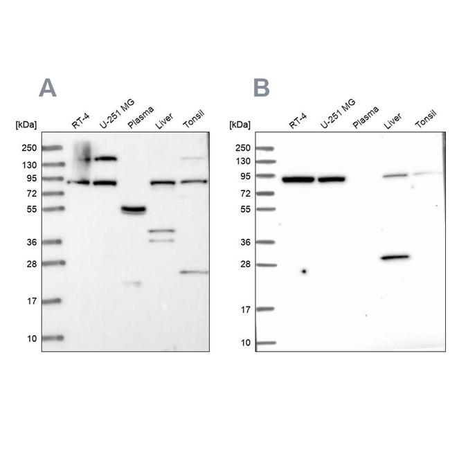 QARS Antibody in Western Blot (WB)