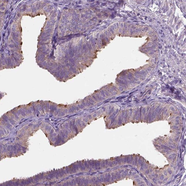 TTC29 Antibody in Immunohistochemistry (IHC)