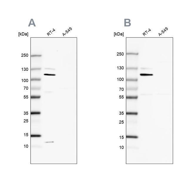 MCC Antibody in Western Blot (WB)