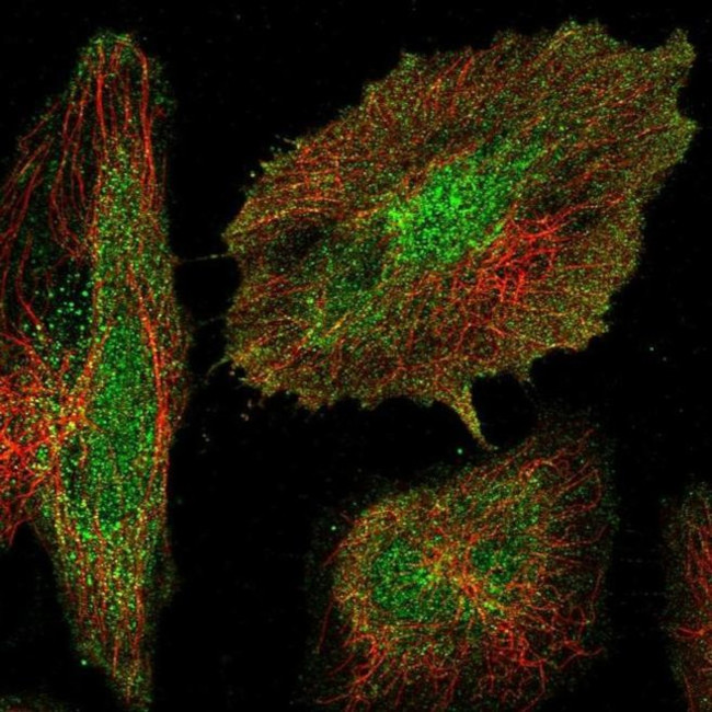 AVPI1 Antibody in Immunocytochemistry (ICC/IF)