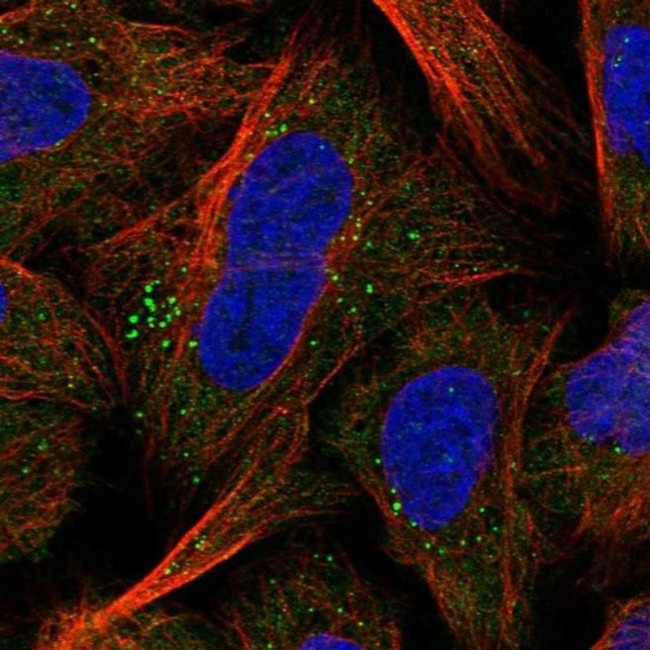 Vasculin Antibody in Immunocytochemistry (ICC/IF)