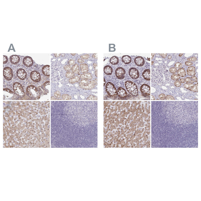 A1CF Antibody in Immunohistochemistry (IHC)