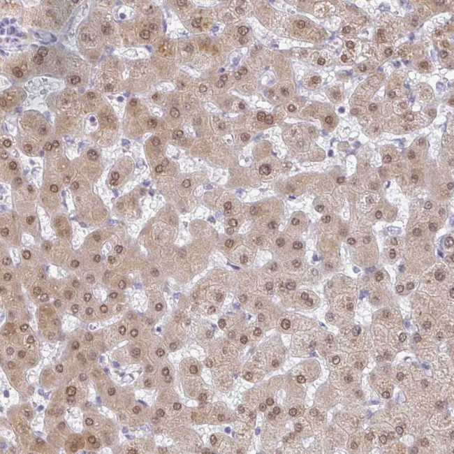 A1CF Antibody in Immunohistochemistry (IHC)