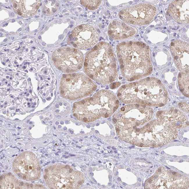 A1CF Antibody in Immunohistochemistry (IHC)