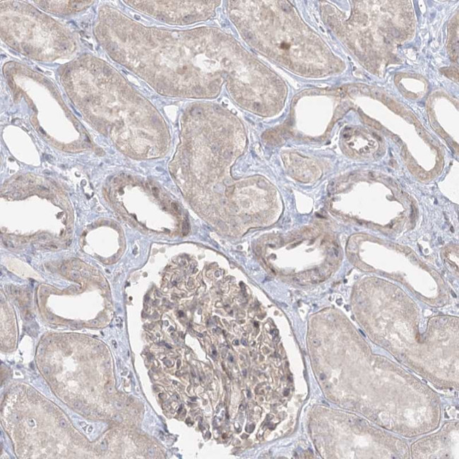 SYTL1 Antibody in Immunohistochemistry (IHC)