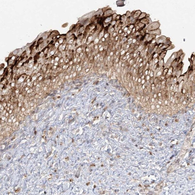 SYTL1 Antibody in Immunohistochemistry (IHC)