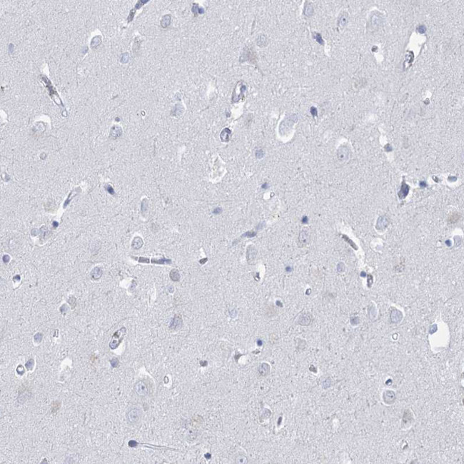 HORMAD1 Antibody in Immunohistochemistry (IHC)