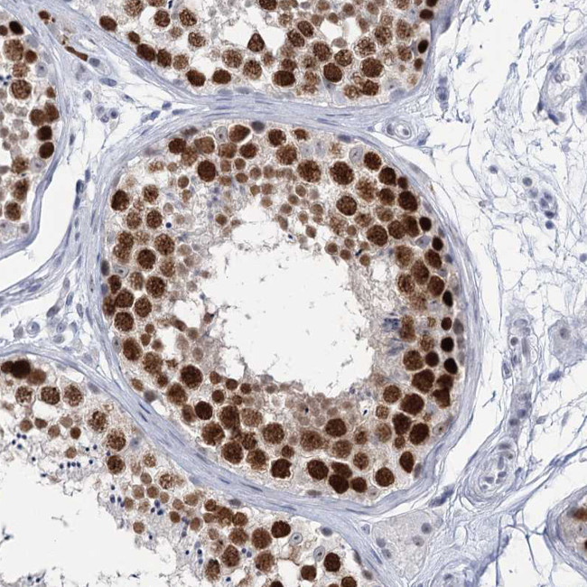 HORMAD1 Antibody in Immunohistochemistry (IHC)