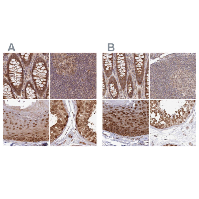 WAPL Antibody in Immunohistochemistry (IHC)