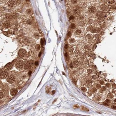 WAPL Antibody in Immunohistochemistry (IHC)