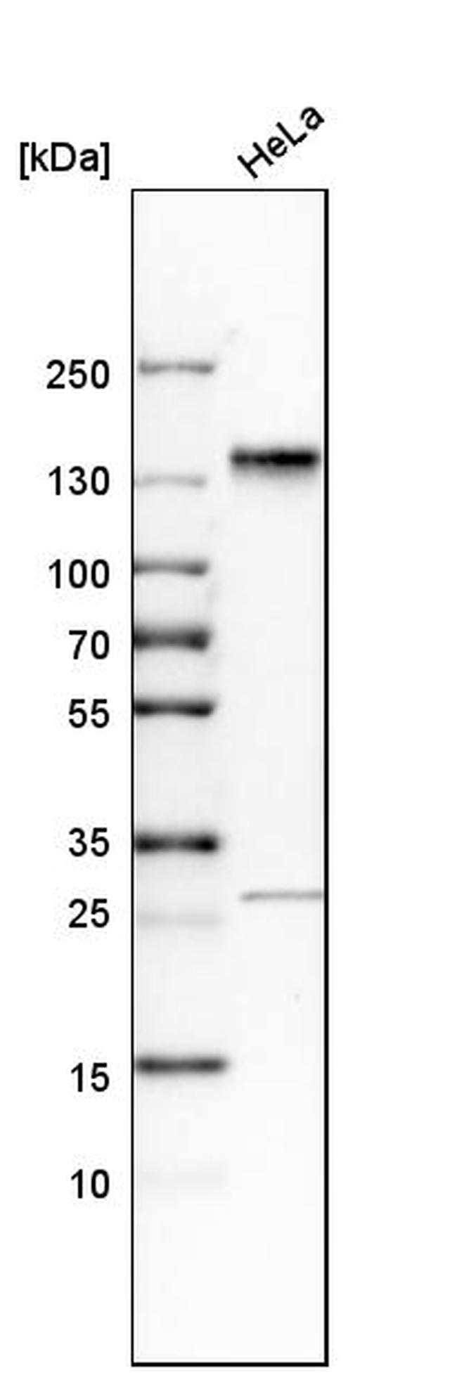 SH3PXD2A Antibody in Western Blot (WB)
