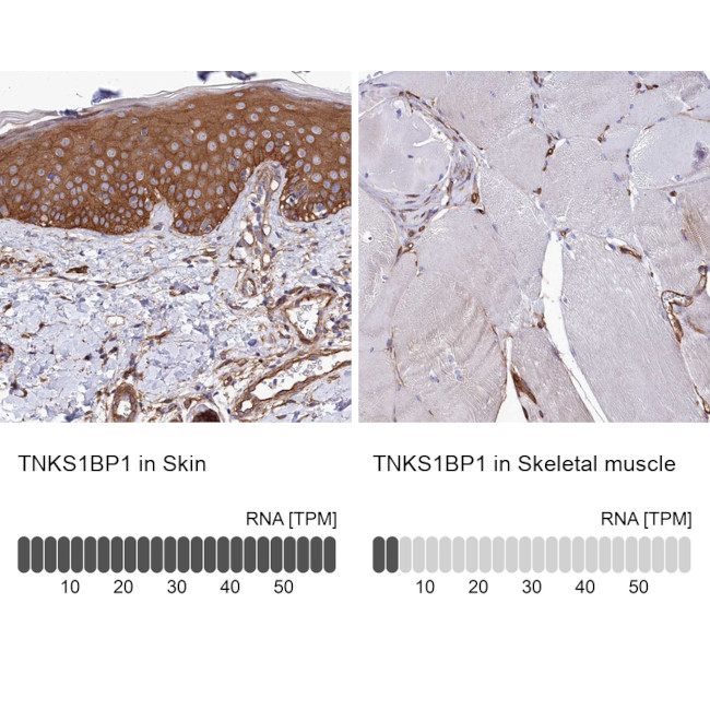 TAB182 Antibody in Immunohistochemistry (IHC)