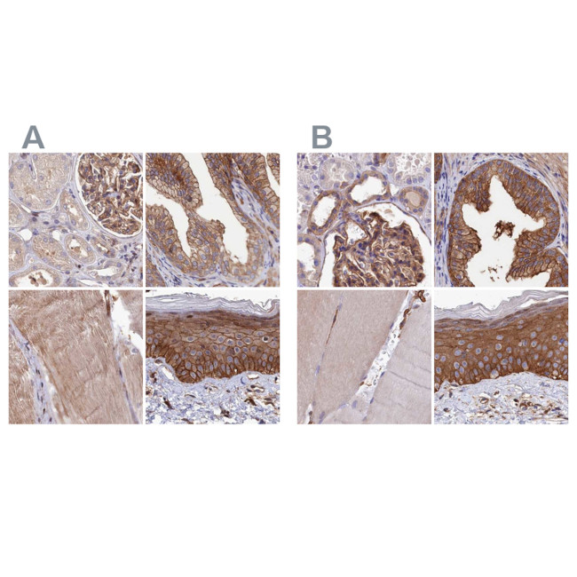 TAB182 Antibody in Immunohistochemistry (IHC)