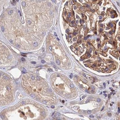 TAB182 Antibody in Immunohistochemistry (IHC)