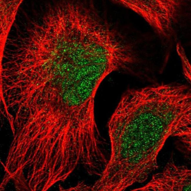 RTKN2 Antibody in Immunocytochemistry (ICC/IF)