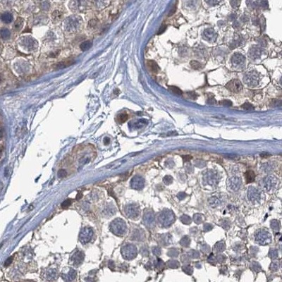 RTKN2 Antibody in Immunohistochemistry (IHC)