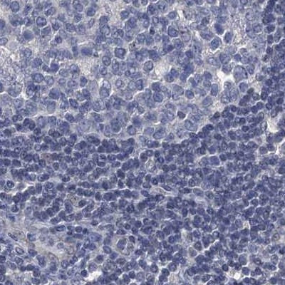 RTKN2 Antibody in Immunohistochemistry (IHC)