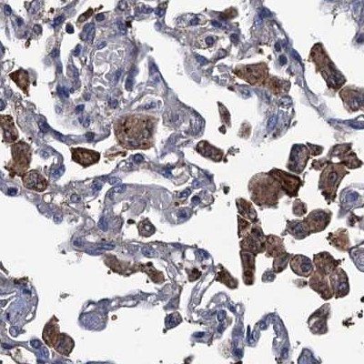 RTKN2 Antibody in Immunohistochemistry (IHC)