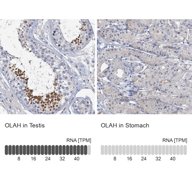 OLAH Antibody in Immunohistochemistry (IHC)