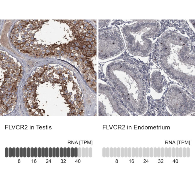 FLVCR2 Antibody in Immunohistochemistry (IHC)