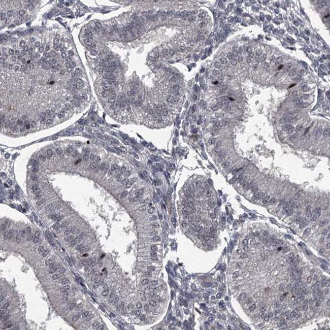 FLVCR2 Antibody in Immunohistochemistry (IHC)