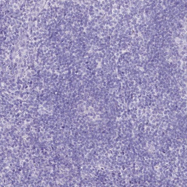 PBLD Antibody in Immunohistochemistry (IHC)