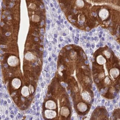 PBLD Antibody in Immunohistochemistry (IHC)