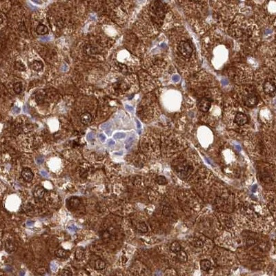 PBLD Antibody in Immunohistochemistry (IHC)