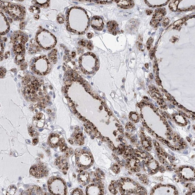 SIAE Antibody in Immunohistochemistry (IHC)