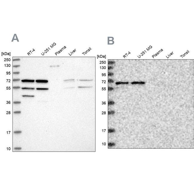 SIAE Antibody in Western Blot (WB)