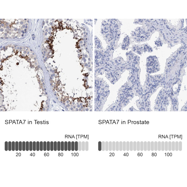 SPATA7 Antibody in Immunohistochemistry (IHC)