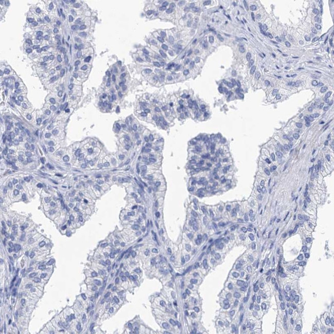 SPATA7 Antibody in Immunohistochemistry (IHC)