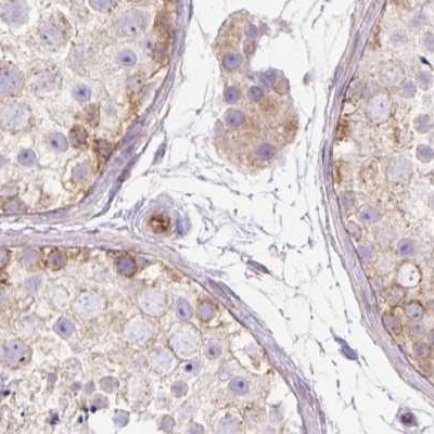 HIP1R Antibody in Immunohistochemistry (IHC)