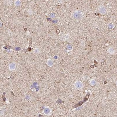 HIP1R Antibody in Immunohistochemistry (IHC)