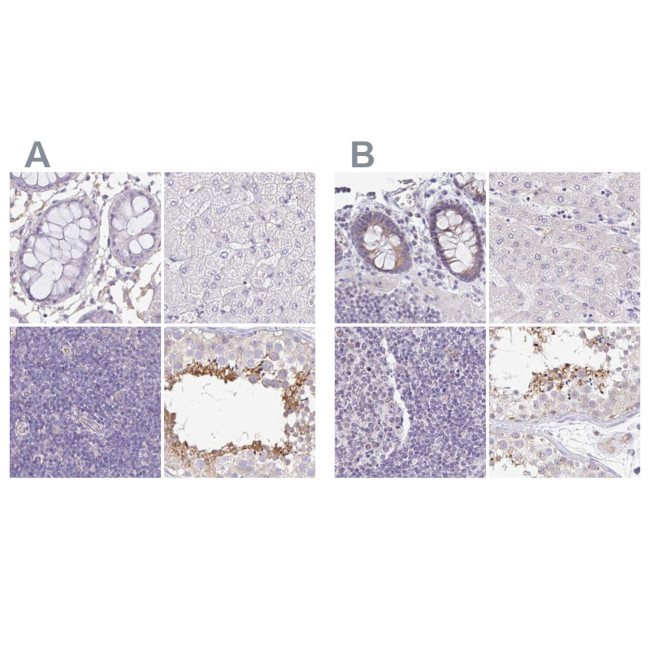 PLCD4 Antibody in Immunohistochemistry (IHC)