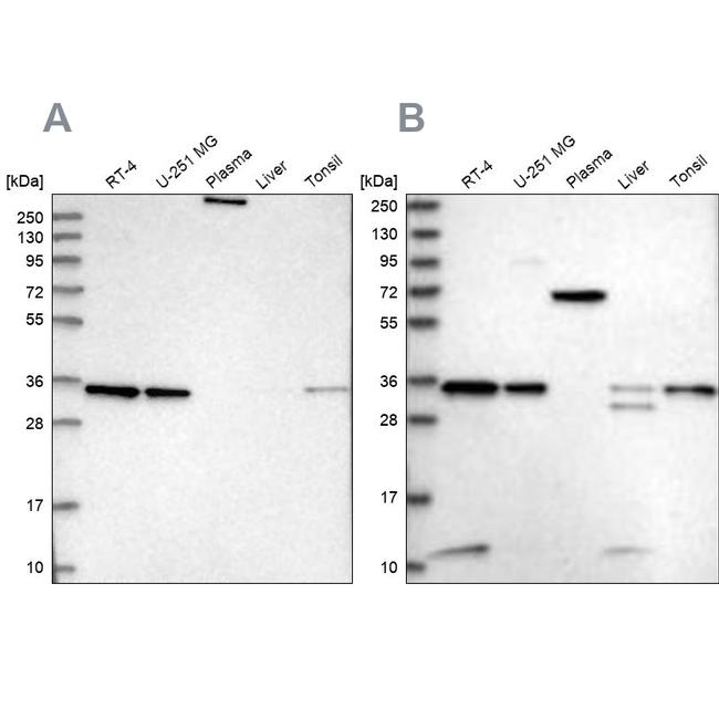 VPS37B Antibody in Western Blot (WB)