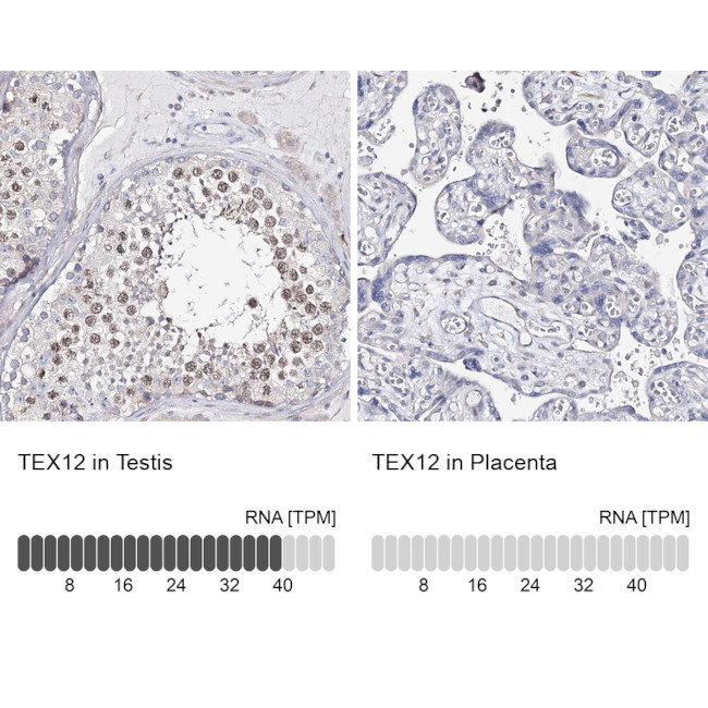 TEX12 Antibody in Immunohistochemistry (IHC)