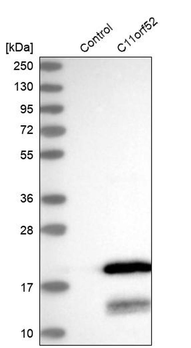 C11orf52 Antibody in Western Blot (WB)