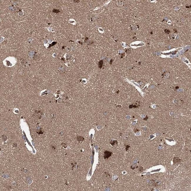 WDR48 Antibody in Immunohistochemistry (IHC)