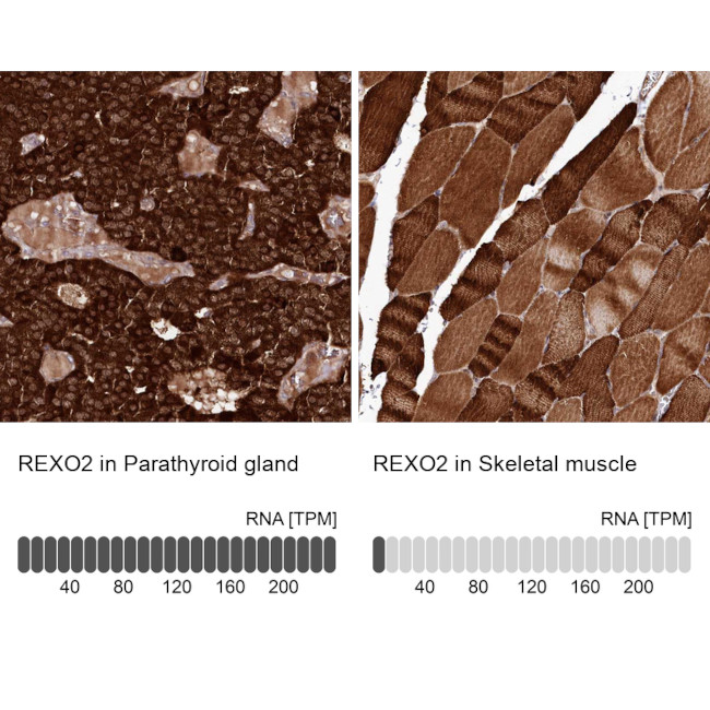 REXO2 Antibody in Immunohistochemistry (IHC)