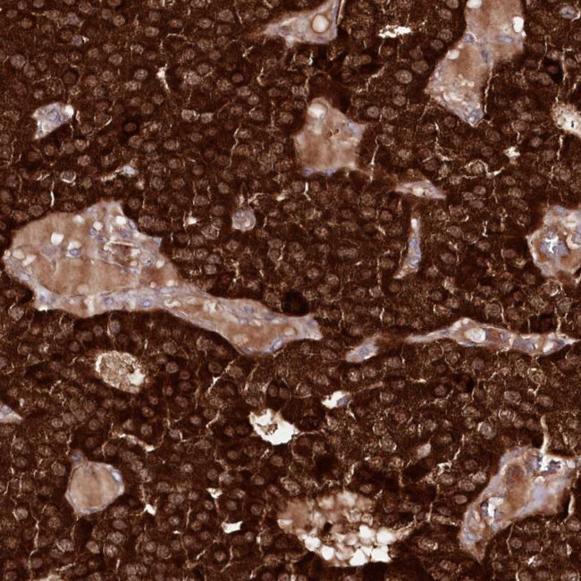 REXO2 Antibody in Immunohistochemistry (IHC)