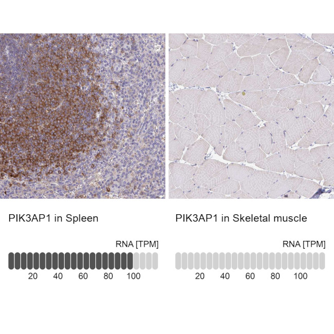 PIK3AP1 Antibody in Immunohistochemistry (IHC)