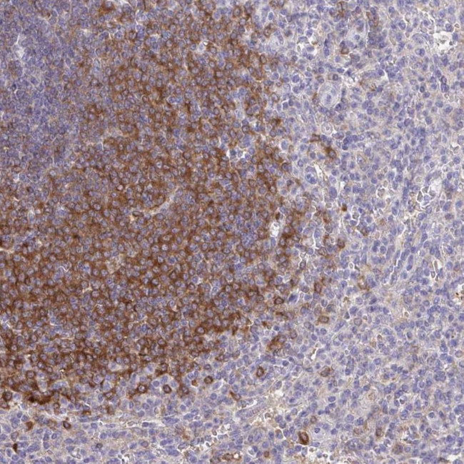 PIK3AP1 Antibody in Immunohistochemistry (IHC)