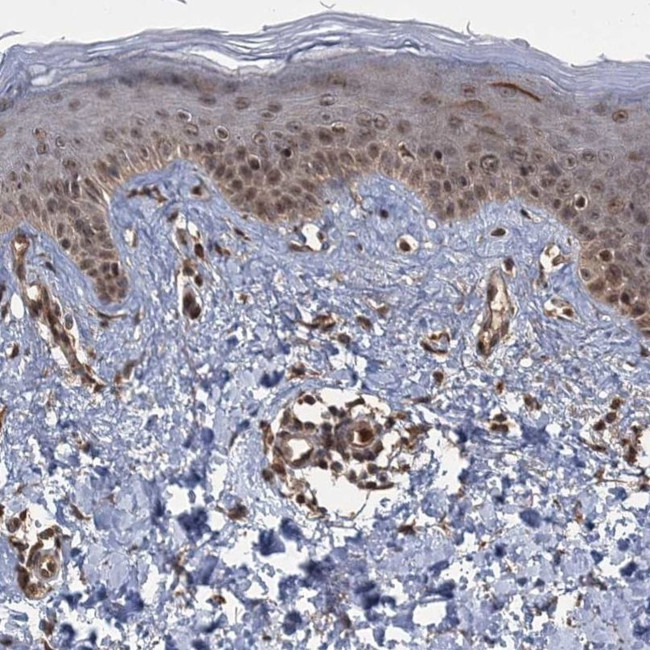 C12orf41 Antibody in Immunohistochemistry (IHC)