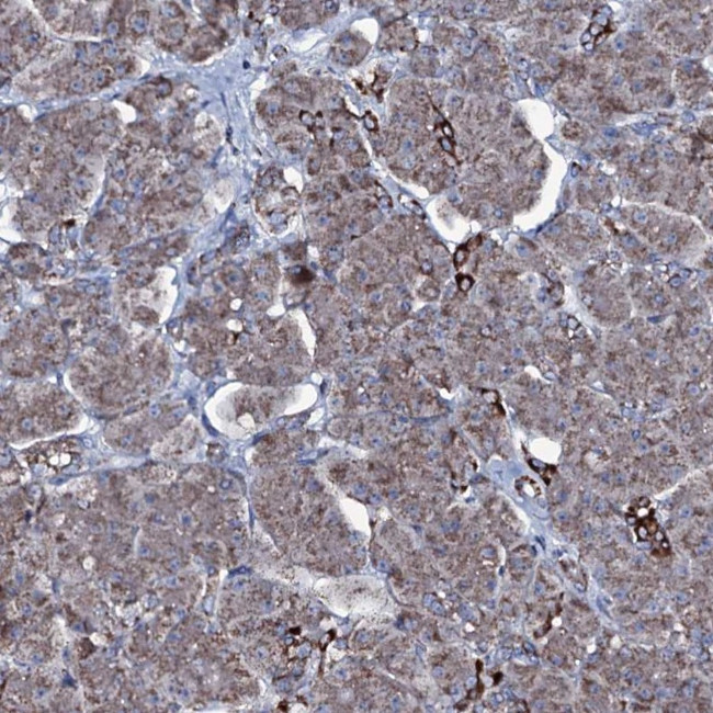 MRPS35 Antibody in Immunohistochemistry (IHC)