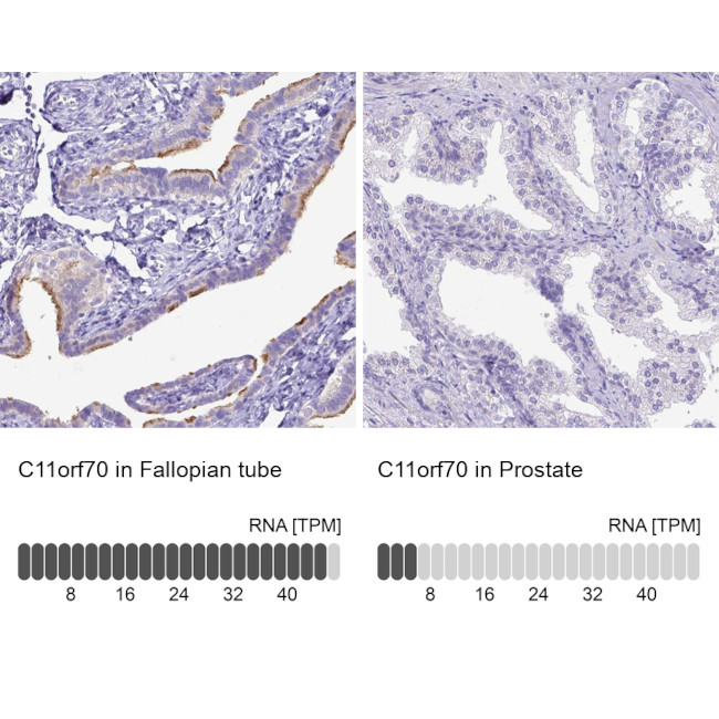 C11orf70 Antibody in Immunohistochemistry (IHC)