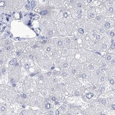 Acrosomal Vesicle Protein Antibody in Immunohistochemistry (IHC)