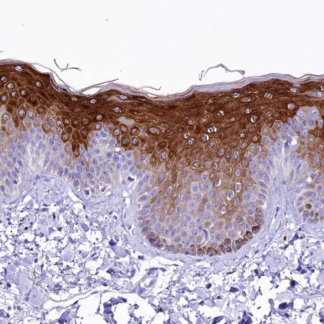 A2ML1 Antibody in Immunohistochemistry (IHC)