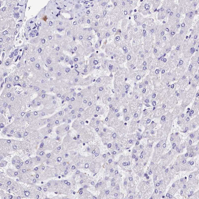 A2ML1 Antibody in Immunohistochemistry (IHC)