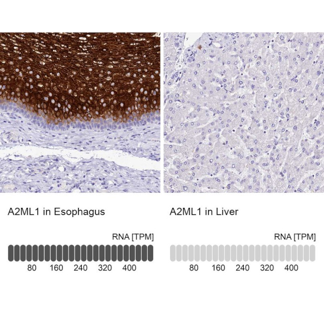 A2ML1 Antibody